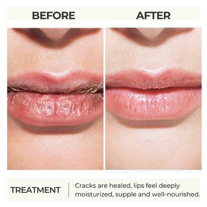 Ultra repair lip balm